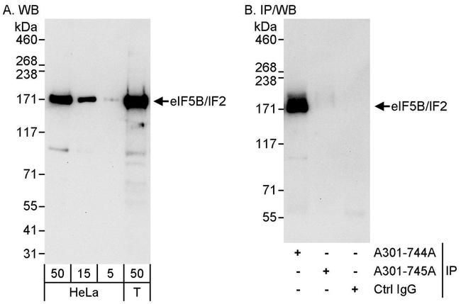 eIF5B/IF2 Antibody in Western Blot (WB)