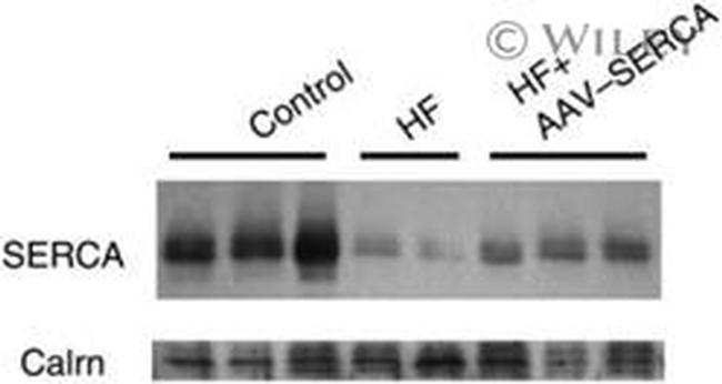 SERCA2 ATPase Antibody in Western Blot (WB)