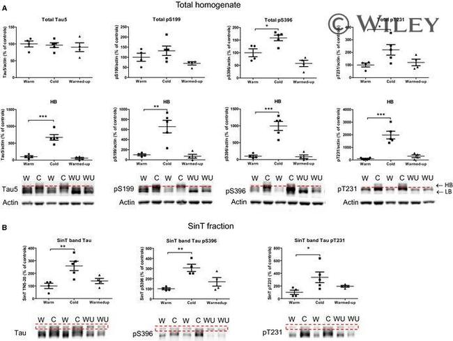 Phospho-Tau (Ser396) Antibody in Western Blot (WB)