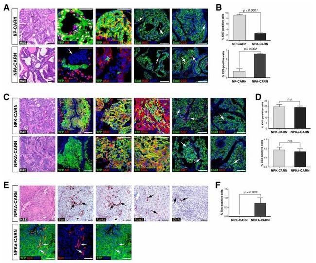 CD324 (E-Cadherin) Antibody in Immunohistochemistry (IHC)