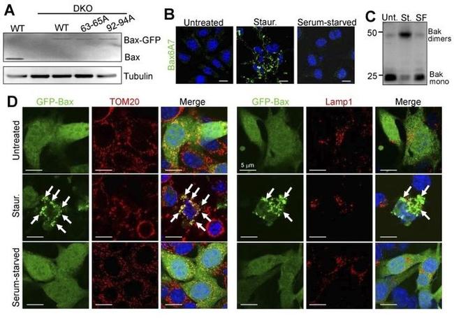 Bax Antibody in Immunohistochemistry (IHC)