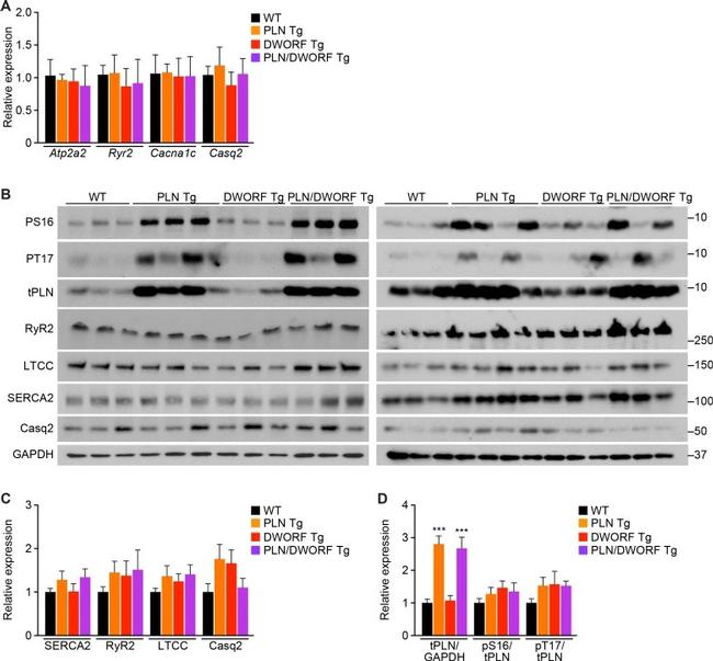 Phospholamban Antibody in Western Blot (WB)