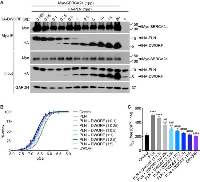 Phospholamban Antibody in Western Blot (WB)