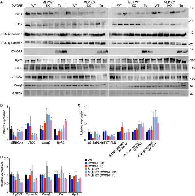 Phospholamban Antibody in Western Blot (WB)