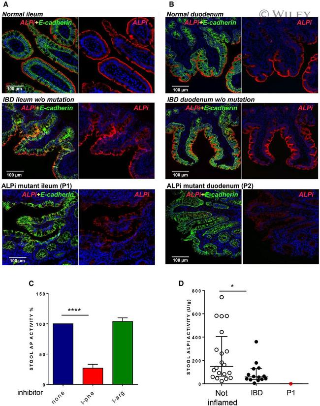 Intestinal Alkaline Phosphatase Antibody in Immunohistochemistry (IHC)