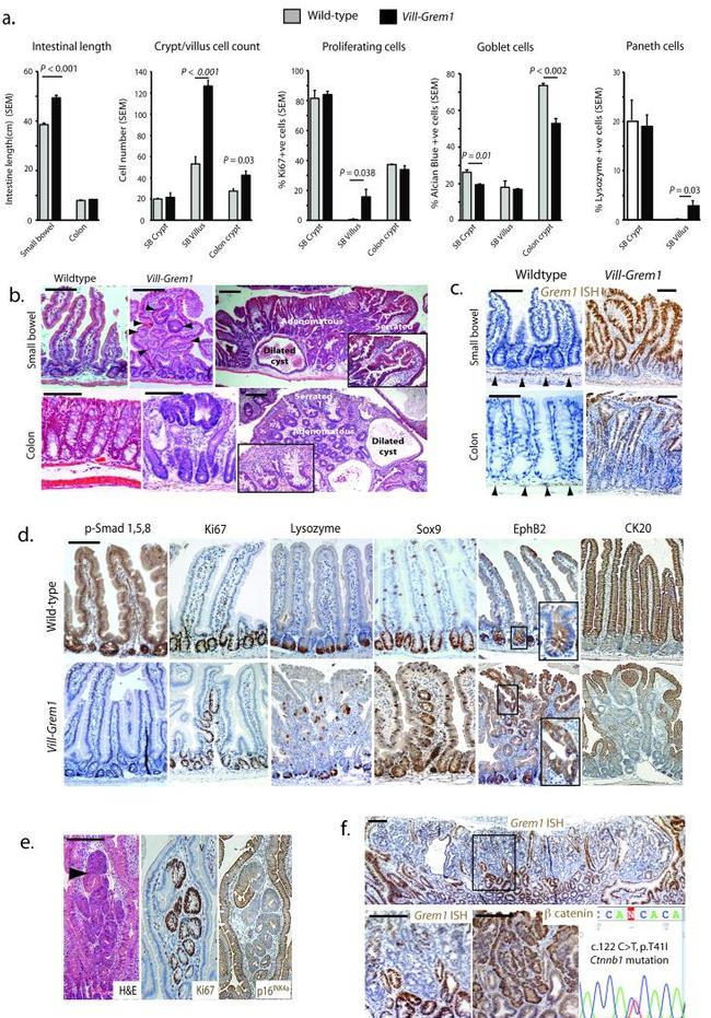 p19ARF Antibody in Immunohistochemistry (Paraffin) (IHC (P))