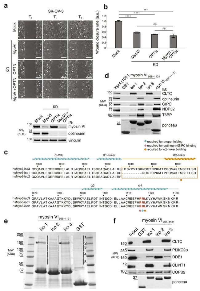 Clathrin Heavy Chain Antibody in Western Blot (WB)