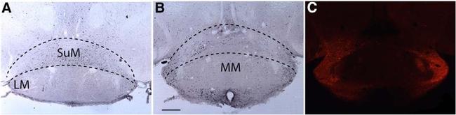 mCherry Antibody in Immunohistochemistry (IHC)