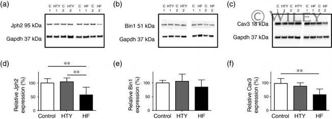 JPH2 Antibody in Western Blot (WB)