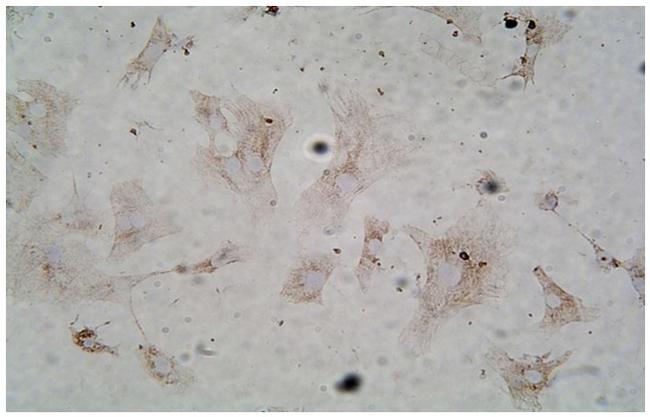 Sarcomeric alpha Actin Antibody in Immunohistochemistry (IHC)