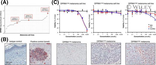 OPRM1 Antibody in Immunohistochemistry (IHC)