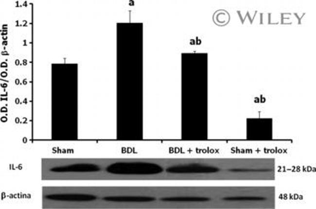 IL-6 Antibody in Western Blot (WB)