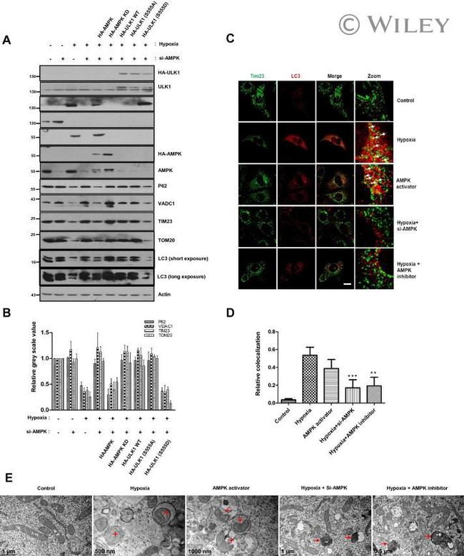 AMPK alpha-1 Antibody in Western Blot (WB)