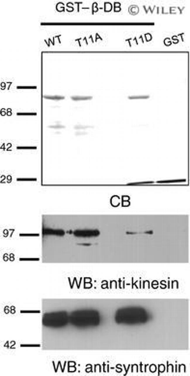 SNTB2 Antibody in Western Blot (WB)