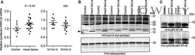 Calsequestrin Antibody in Western Blot (WB)