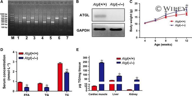 ATGL Antibody in Western Blot (WB)