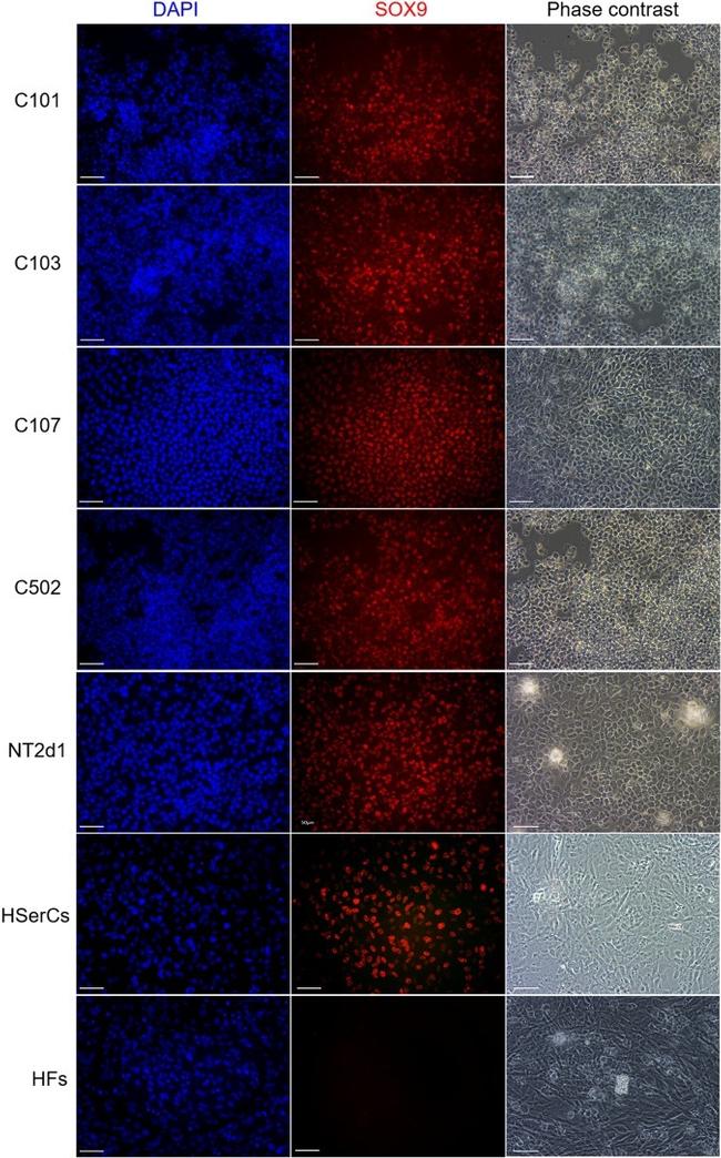 SOX9 Antibody in Immunocytochemistry (ICC/IF)