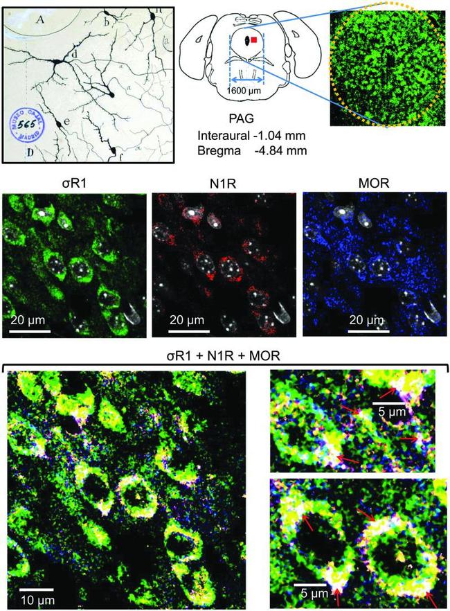 Sigma-1 Receptor Antibody in Immunohistochemistry (IHC)