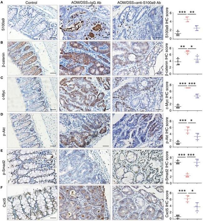 Phospho-SMAD2 (Ser465, Ser467) Antibody in Immunohistochemistry (IHC)