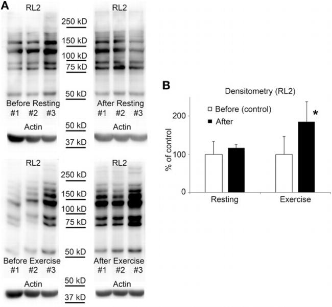 O-linked N-acetylglucosamine (O-GlcNAc) Antibody in Western Blot (WB)