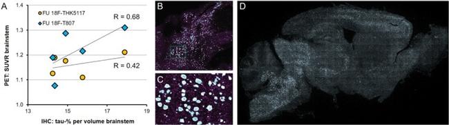 Tau Antibody in Immunohistochemistry (IHC)