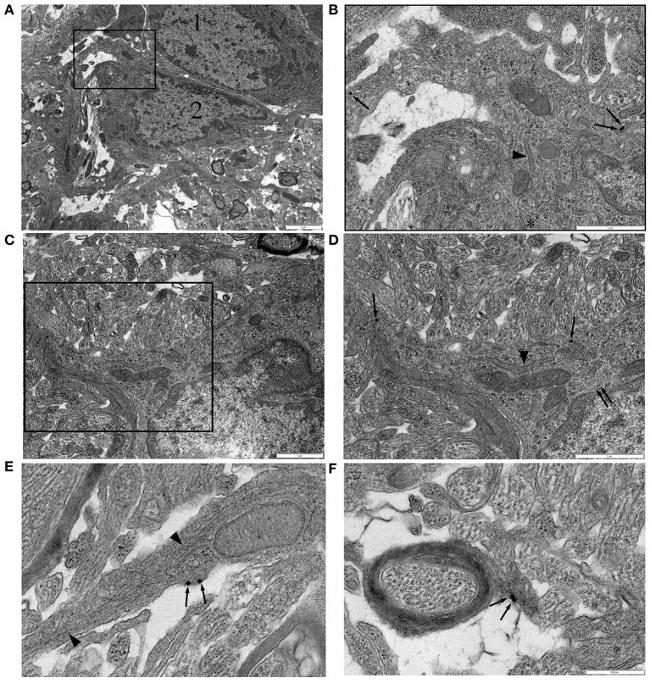 NG2 Antibody in Immunohistochemistry, Immunomicroscopy (IHC, IM)