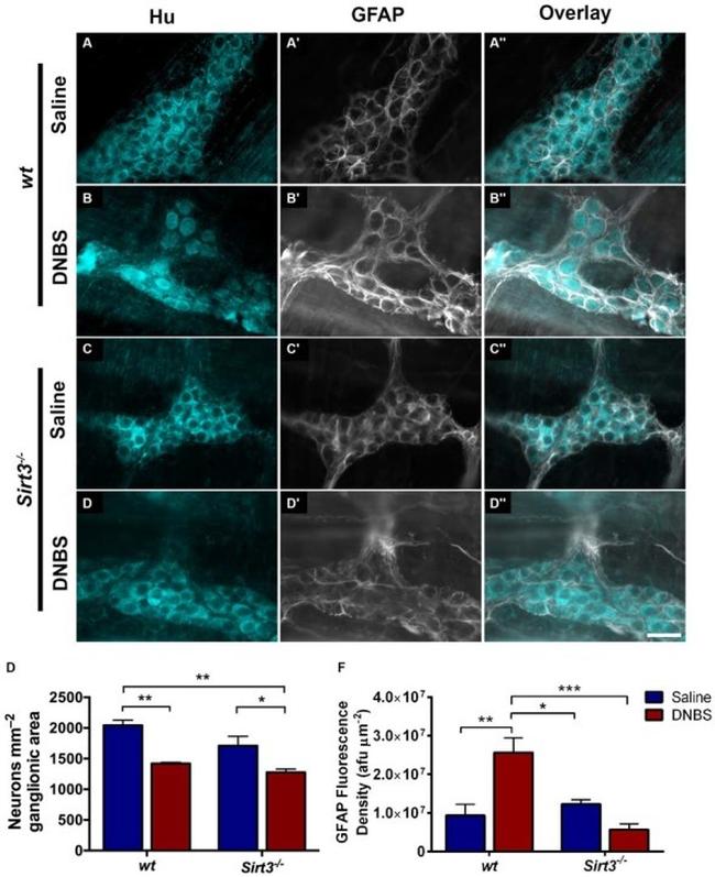 HuC/HuD Antibody in Immunohistochemistry (IHC)