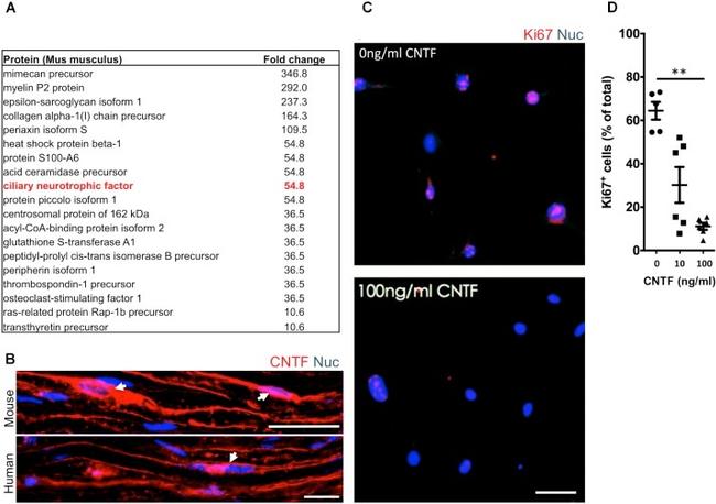 Ki-67 Antibody in Immunocytochemistry (ICC/IF)