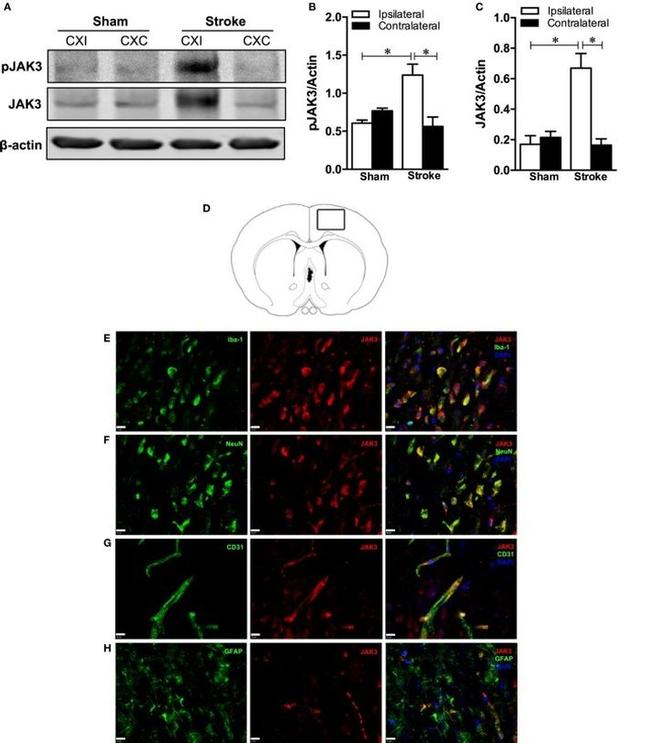 JAK3 Antibody in Western Blot, Immunocytochemistry (WB, ICC/IF)