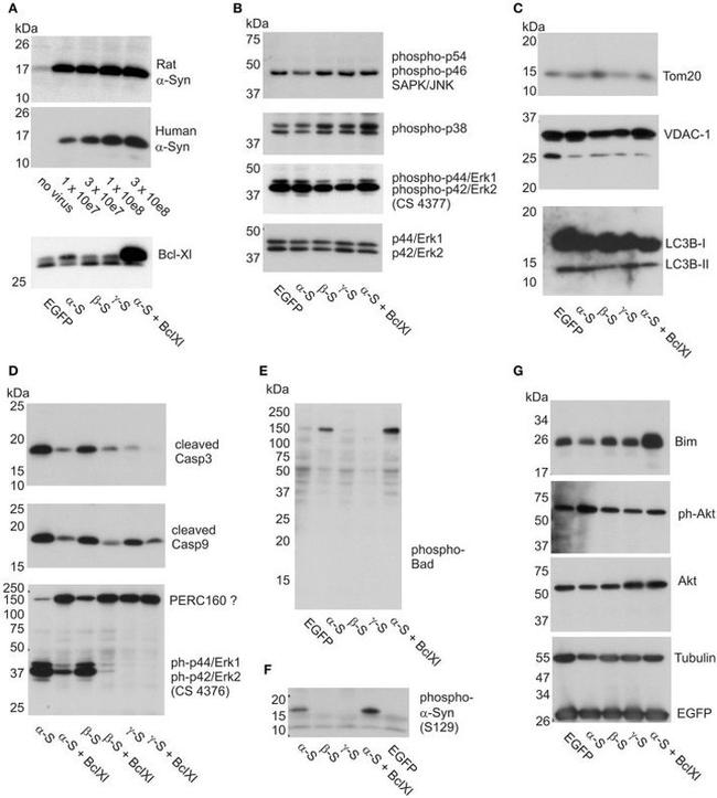 alpha Synuclein Antibody in Western Blot (WB)