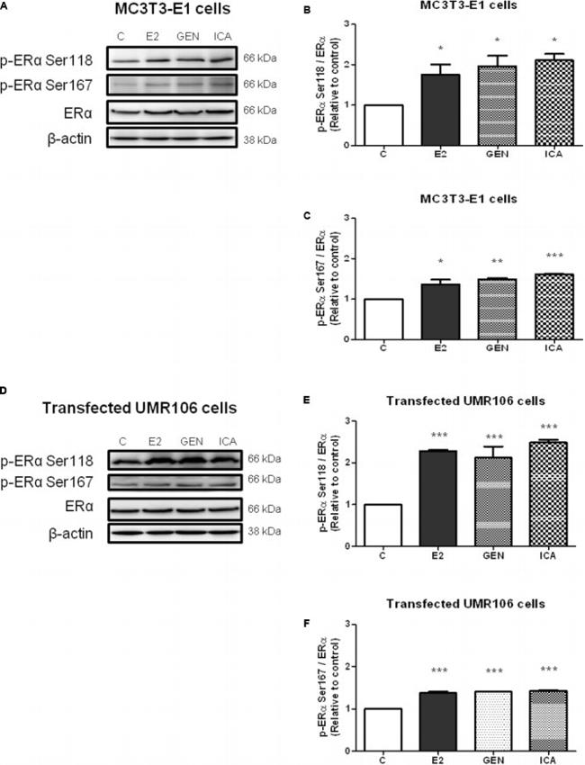 Phospho-Estrogen Receptor alpha (Ser167) Antibody in Western Blot (WB)