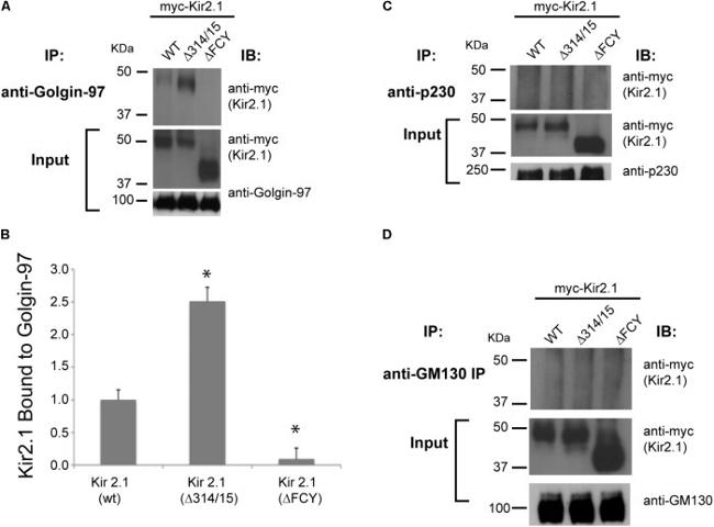 Golgin-97 Antibody in Western Blot, Immunoprecipitation (WB, IP)