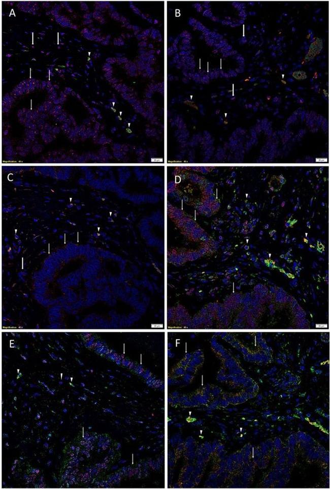 SOX2 Antibody in Immunohistochemistry (IHC)