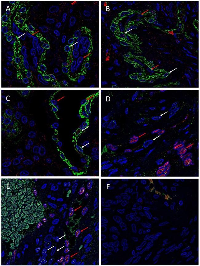 SOX2 Antibody in Immunohistochemistry (IHC)