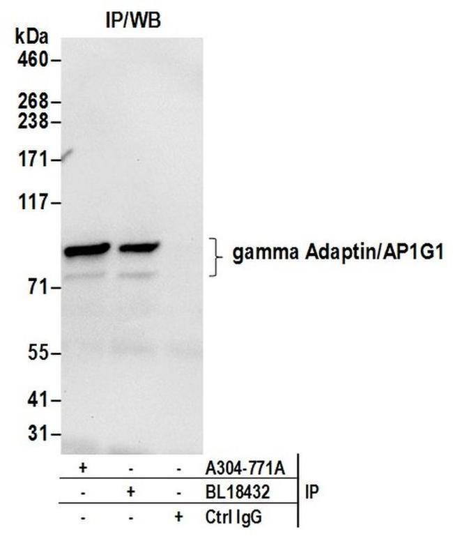 gamma Adaptin/AP1G1 Antibody in Western Blot (WB)