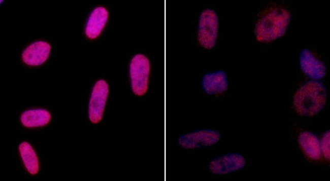 Phospho-gamma-H2AX (Ser139) Antibody in Immunocytochemistry (ICC/IF)