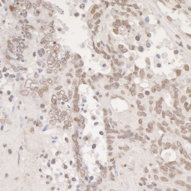 Phospho-gamma-H2AX (Ser139) Antibody in Immunohistochemistry (IHC)