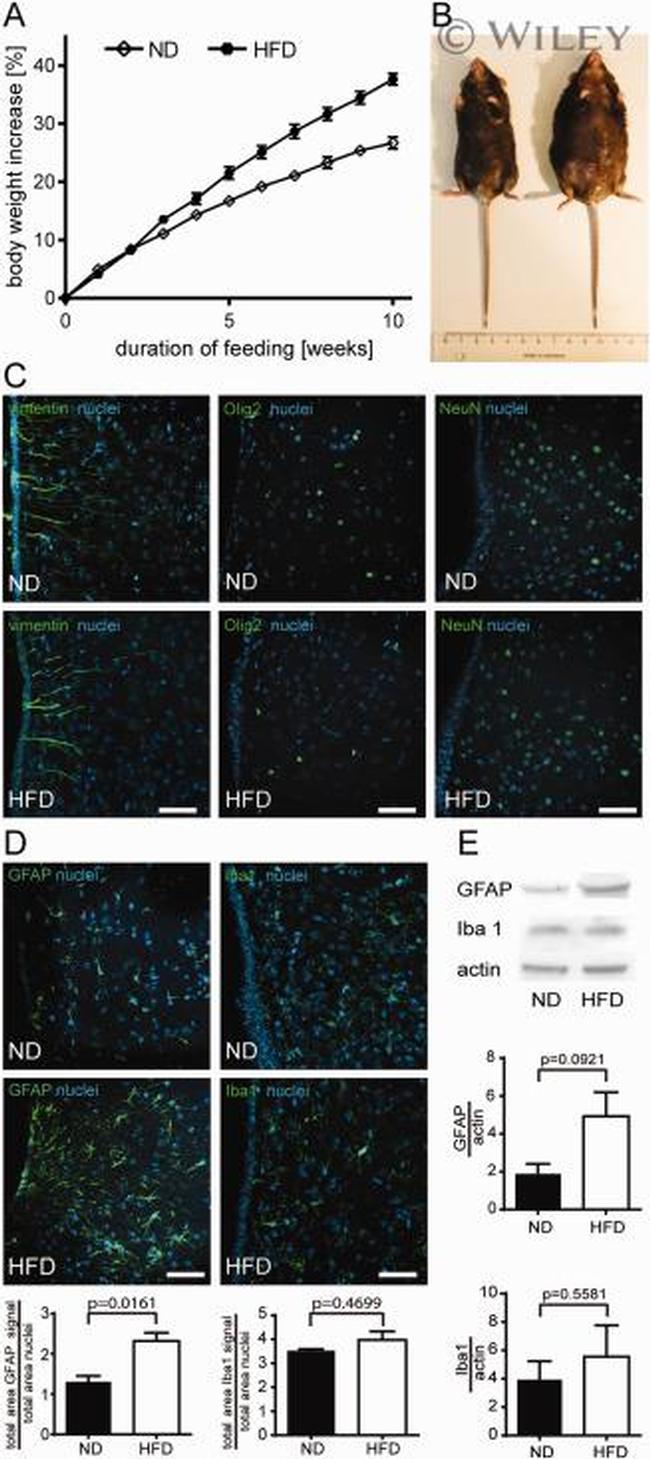 Vimentin Antibody in Immunohistochemistry (IHC)