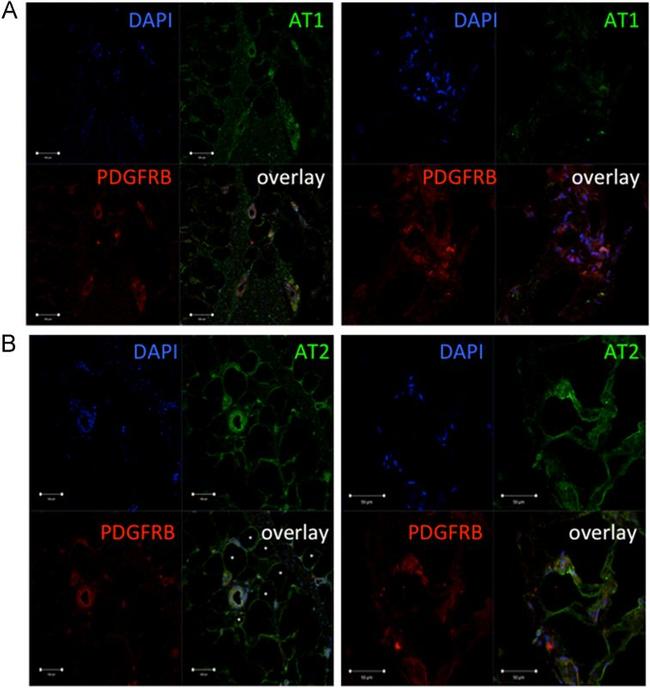 AGTR1 Antibody in Immunohistochemistry (IHC)