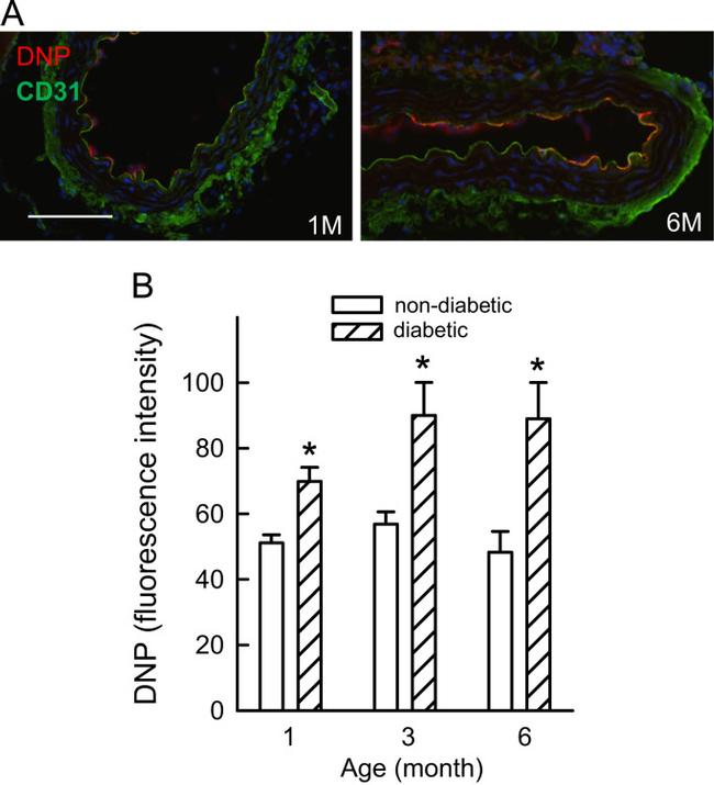 Dinitrophenyl-KLH Antibody in Immunohistochemistry (IHC)