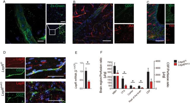 Vimentin Antibody in Immunohistochemistry (IHC)