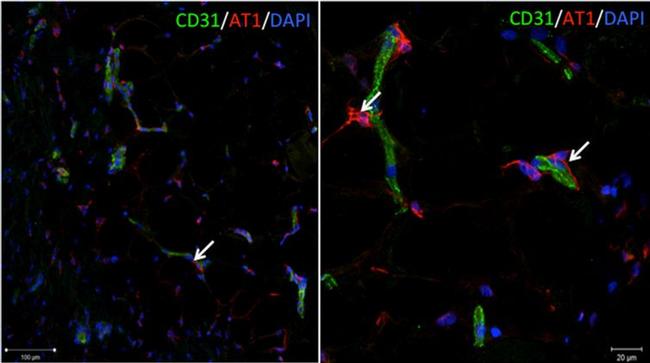 AGTR1 Antibody in Immunohistochemistry (IHC)