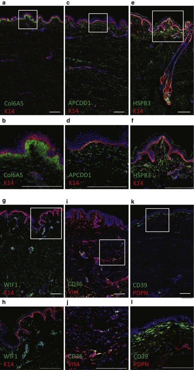 CD39 Antibody in Immunohistochemistry (IHC)