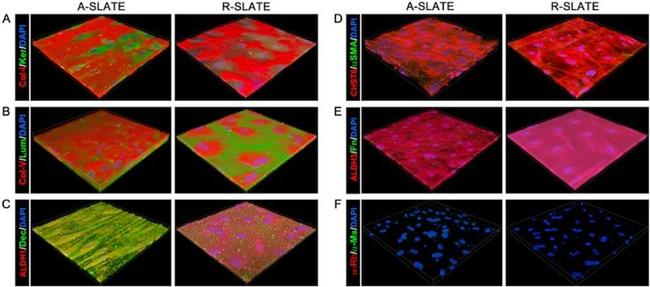 ALDH3A1 Antibody in Immunocytochemistry (ICC/IF)