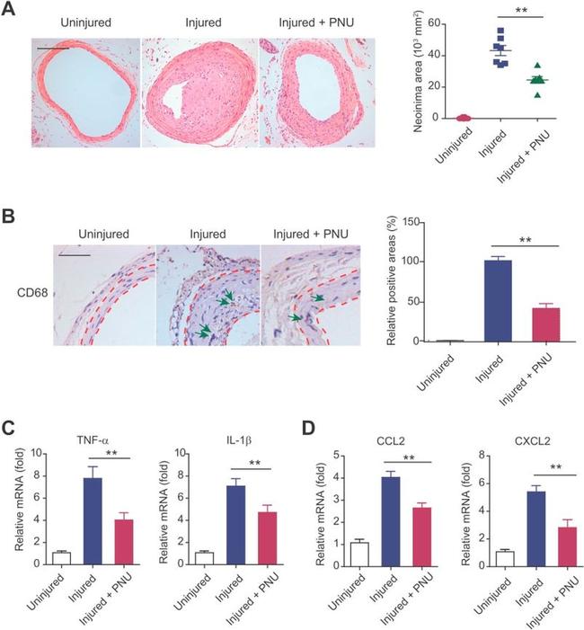 CD68 Antibody in Immunohistochemistry (IHC)