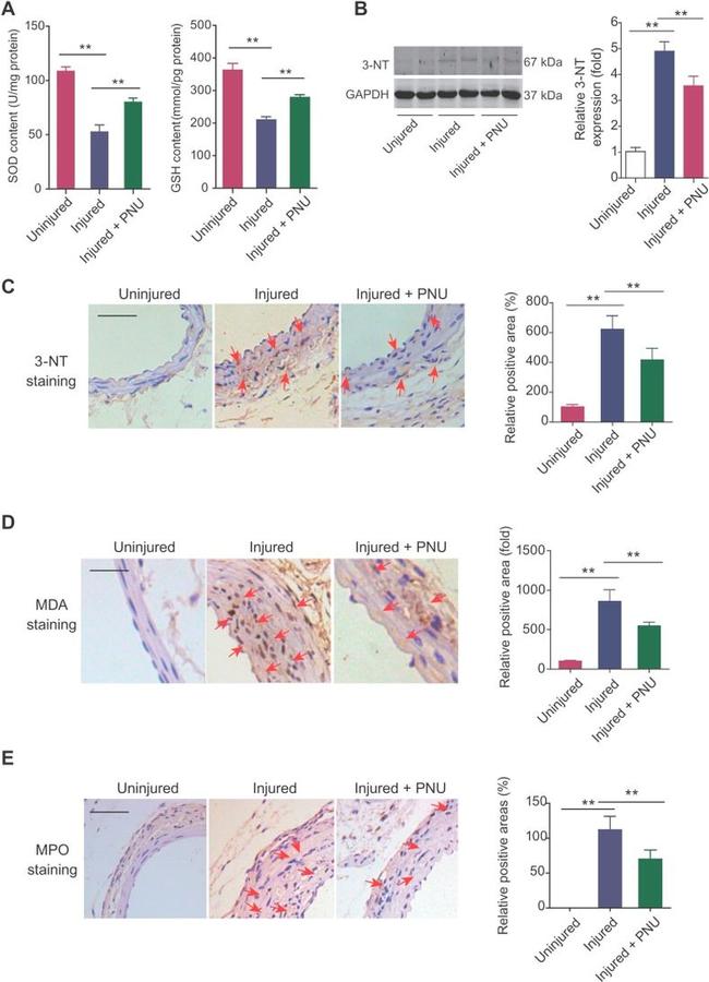 Myeloperoxidase Antibody in Immunohistochemistry (IHC)