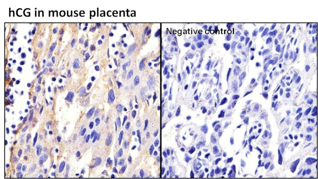 hCG Antibody in Immunohistochemistry (Paraffin) (IHC (P))