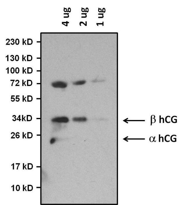 hCG Antibody in Western Blot (WB)