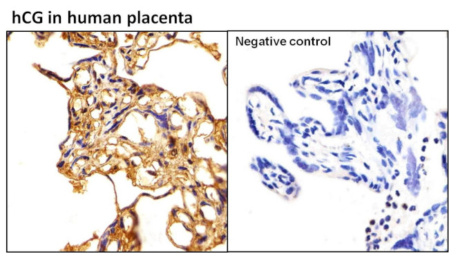 hCG Antibody in Immunohistochemistry (Paraffin) (IHC (P))