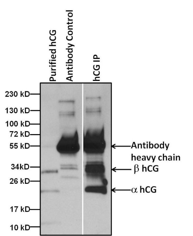 hCG Antibody in Immunoprecipitation (IP)